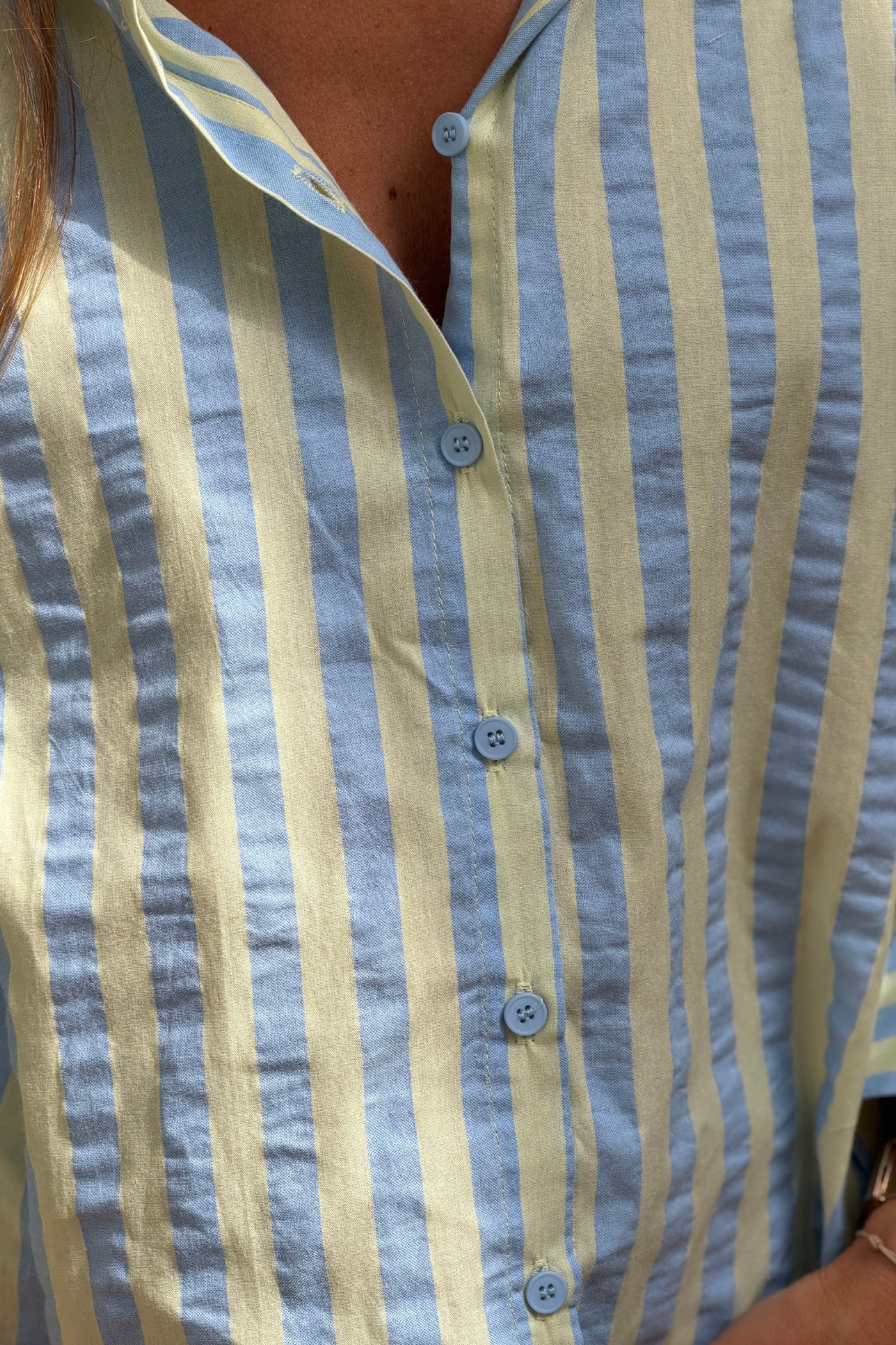 Blue Cabana Stripe Cotton Button-Down Blouse